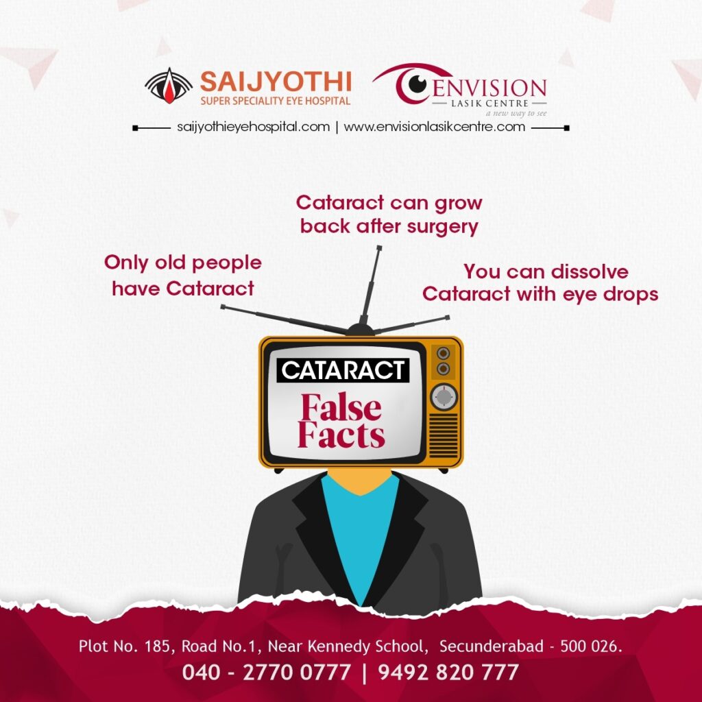 Cataract Eye Surgery