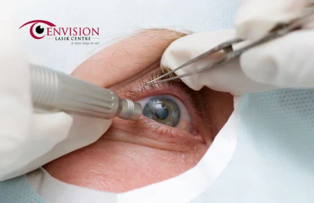 Do's and Don'ts After ICL Surgery