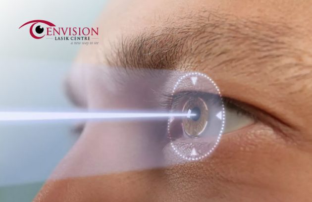 How long does contoura lasik last?