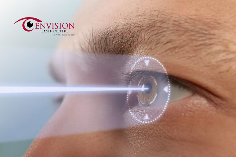 How long does contoura lasik last?