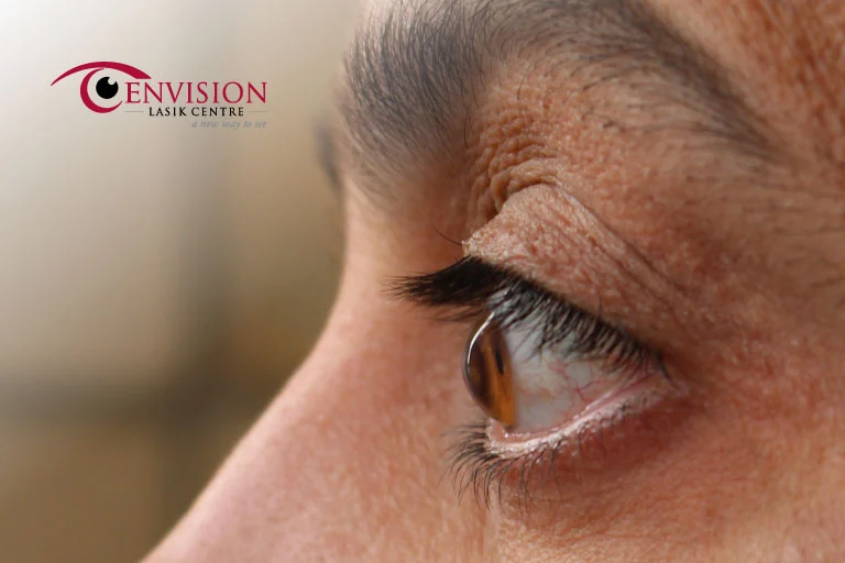 Can keratoconus cause blindness?