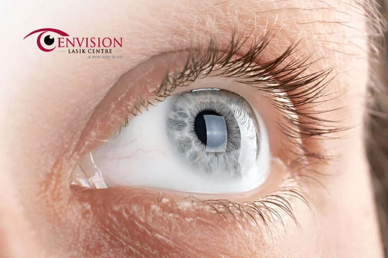 Is Keratoconus the Same as Corneal Dystrophy?