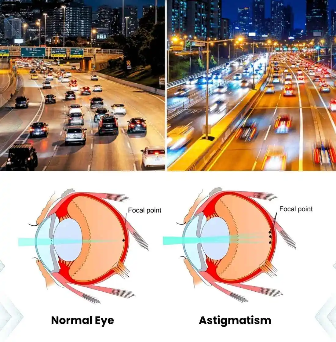 Understanding Astigmatism