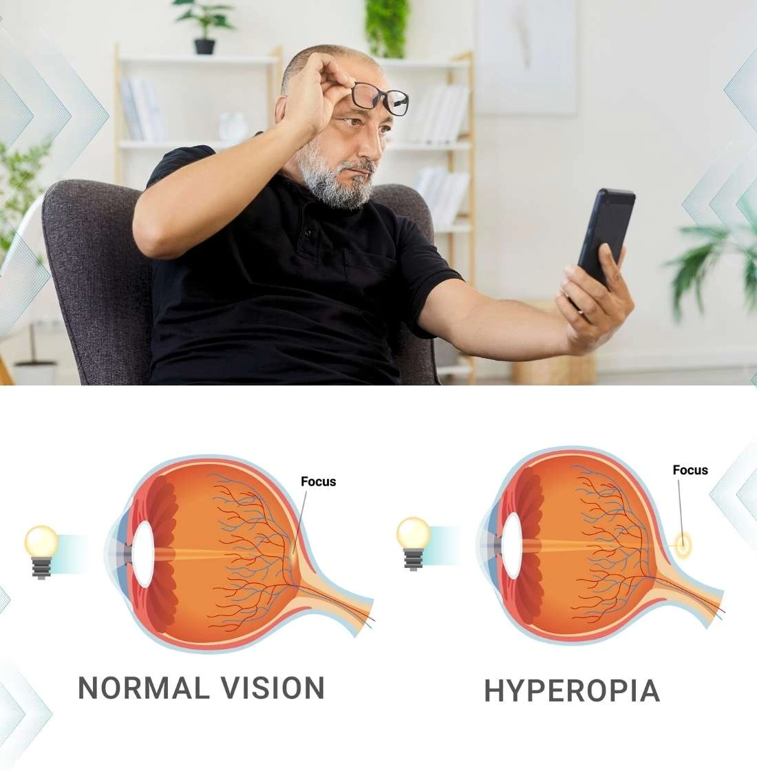 Understanding Hyperopia
