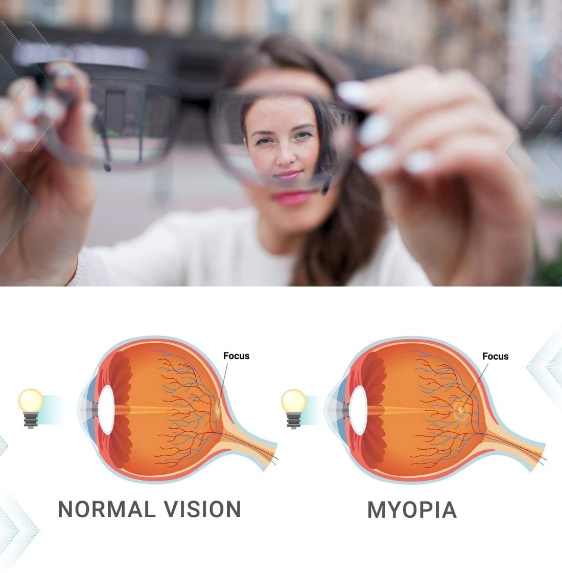 Understanding Myopia.